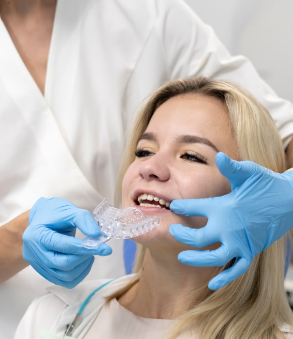 clear aligners candidate min