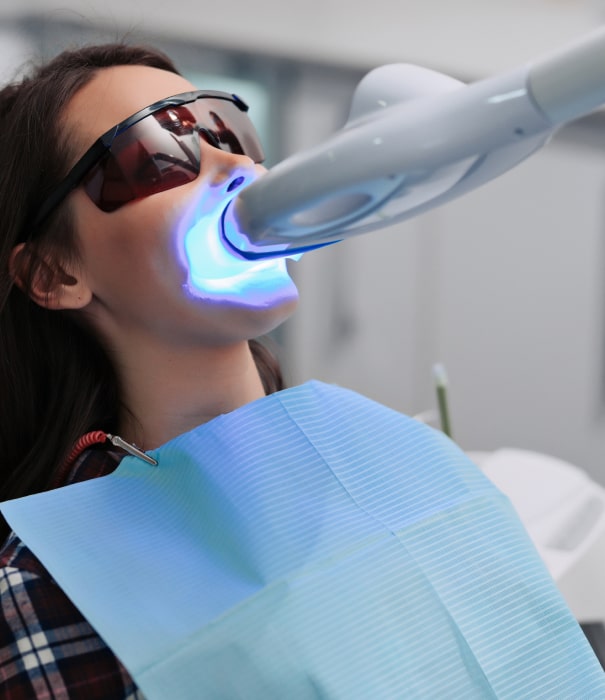 teeth whitening top min