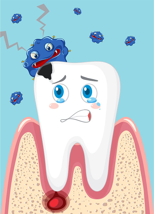 abscess new image min