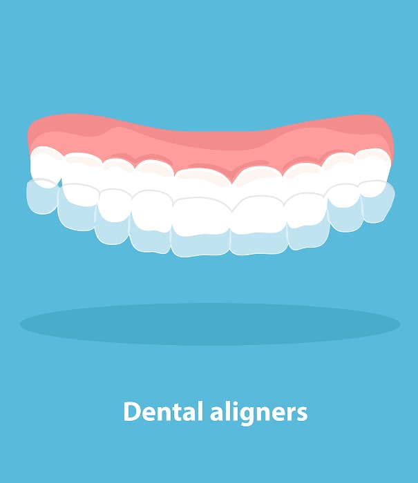 benefits of dental aligners min