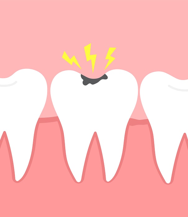 broken tooth repair dental min