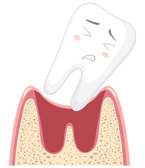loose teeth min