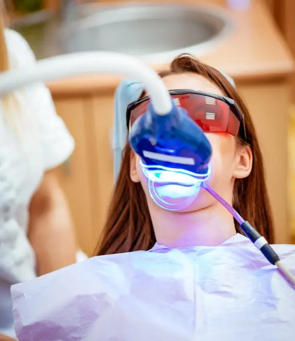 Are You an Ideal Teeth Whitening Procedure Candidate