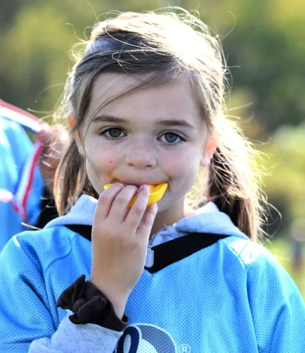 Why Choose a Custom Mouthguard