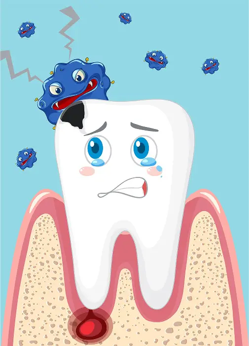 Find Out if You're a Candidate for Dental Abscess Treatment