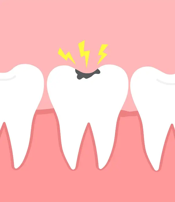 Emergency Broken Tooth Repair Suitable for Your Situation