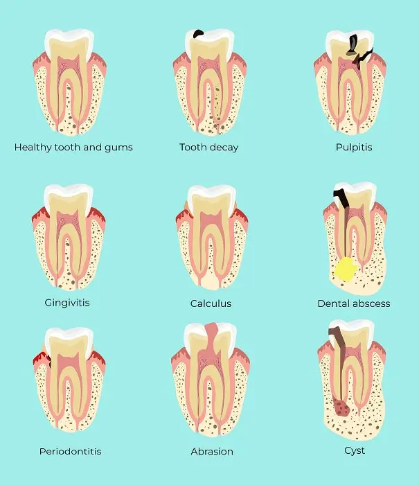 When to See an Emergency Dentist for a Toothache