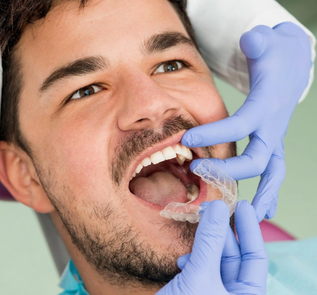Clinician wearing blue gloves fitting a clear aligner tray onto a man's lower teeth