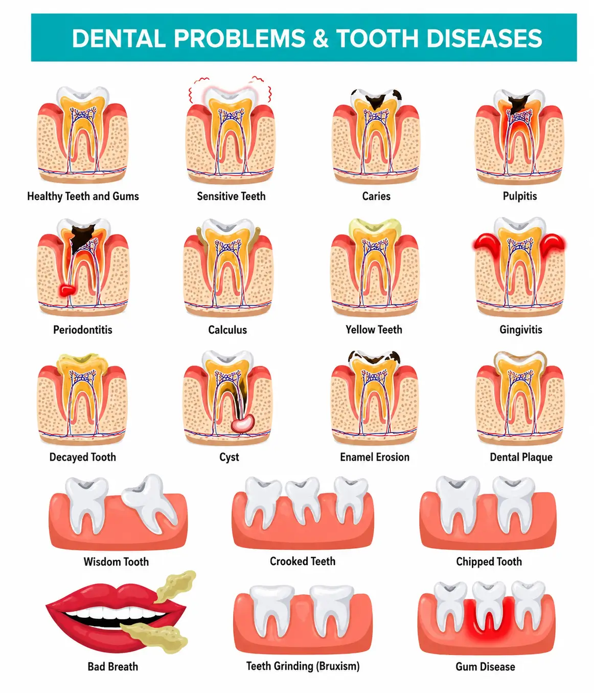common dental problems tooth diseases infographic