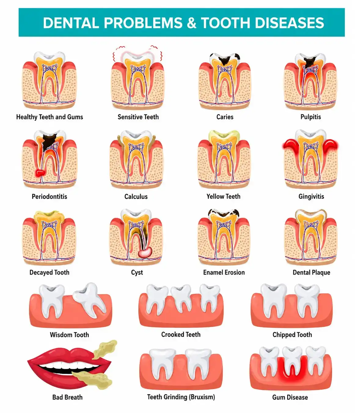 common dental problems tooth diseases infographic