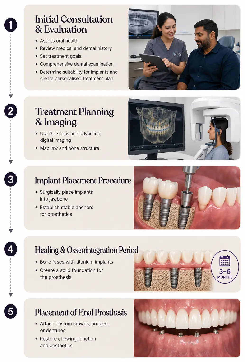 Step-by-step infographic explaining the dental implant treatment process from consultation to final restoration