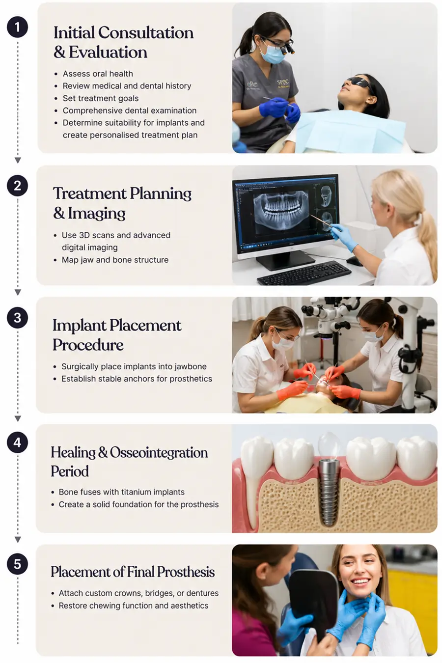 Dental implant treatment process showing consultation, treatment planning, implant placement, healing, and final prosthesis