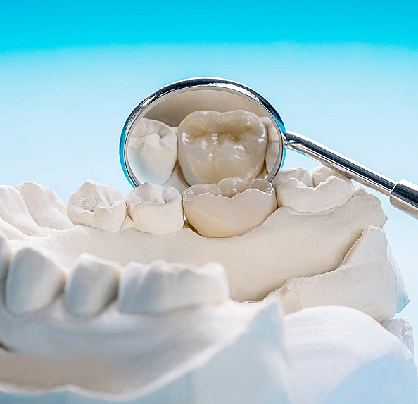 dental mirror reflecting ceramic crown plaster model