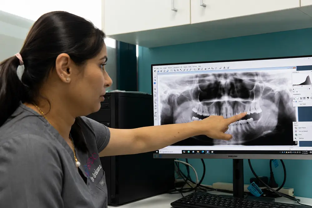 Dentist reviewing a panoramic dental X-ray during a consultation