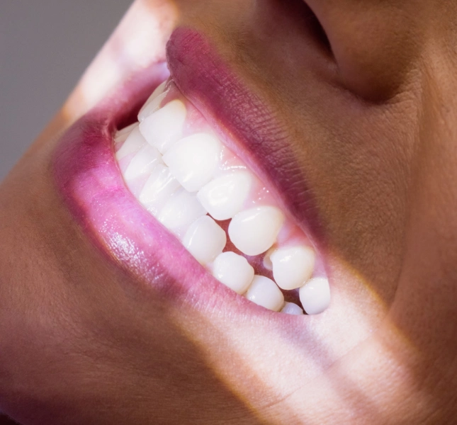 Extreme close-up of a smiling woman's teeth illuminated by a bright examination light