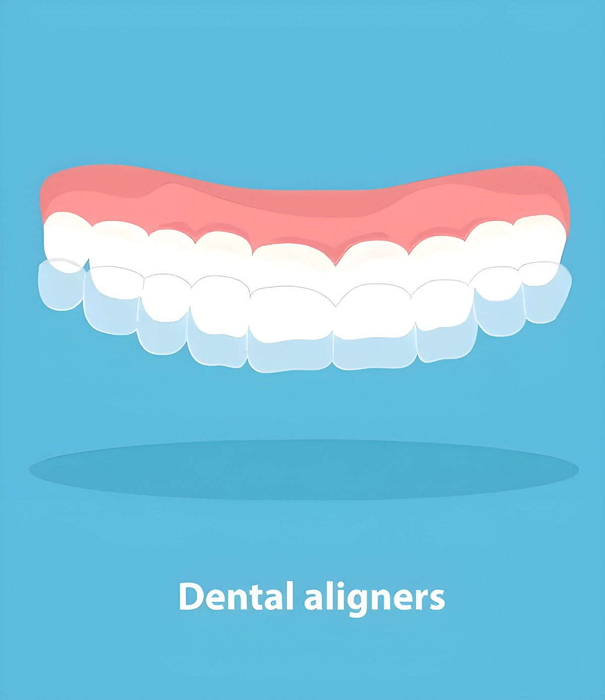 Illustration of upper teeth with a clear dental aligner tray and the text Dental aligners