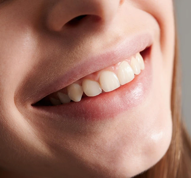 Close-up of a person smiling with teeth visible