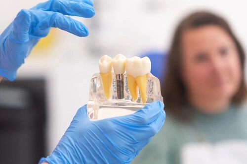 dental implant consultation photo dental implant consultation photo
